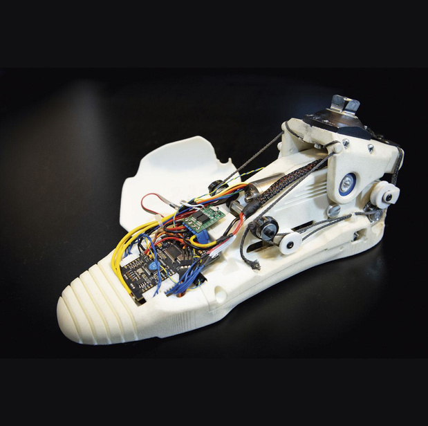 Prothèse Bionics